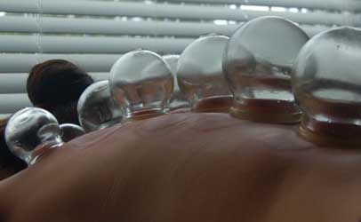 Cupping produces a strong suction on the skin