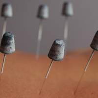 2 forms of Moxibustion - Direct & Indirect